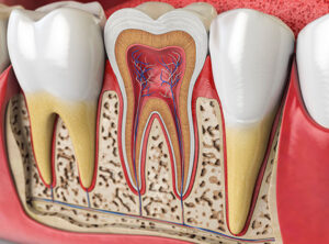 Kanal Tedavisi Yan Etkileri