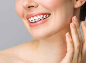 Read more about the article Yetişkinlerde Tel Tedavisi